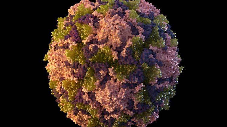 New York reports 1st US polio case in nearly a decade