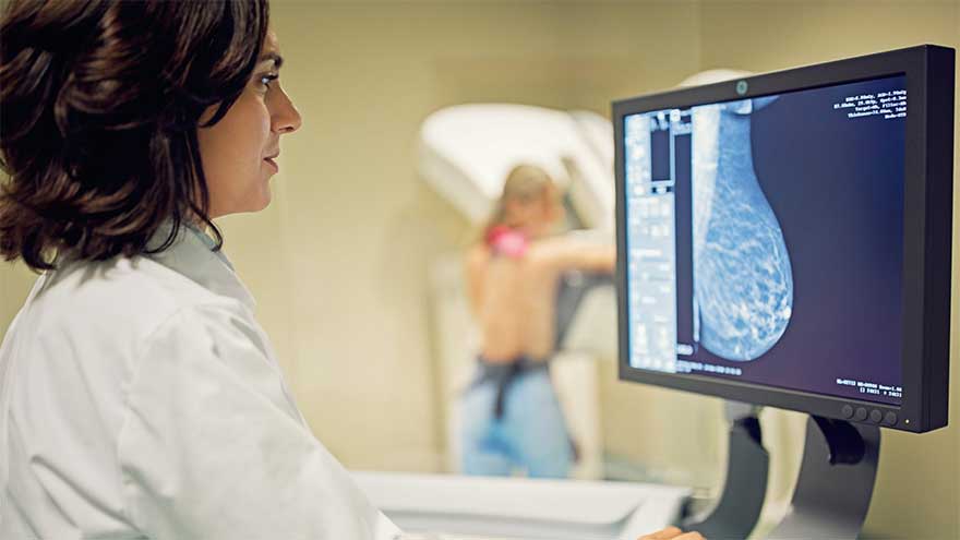 AI helps radiologists keep an eye on breast cancer detection