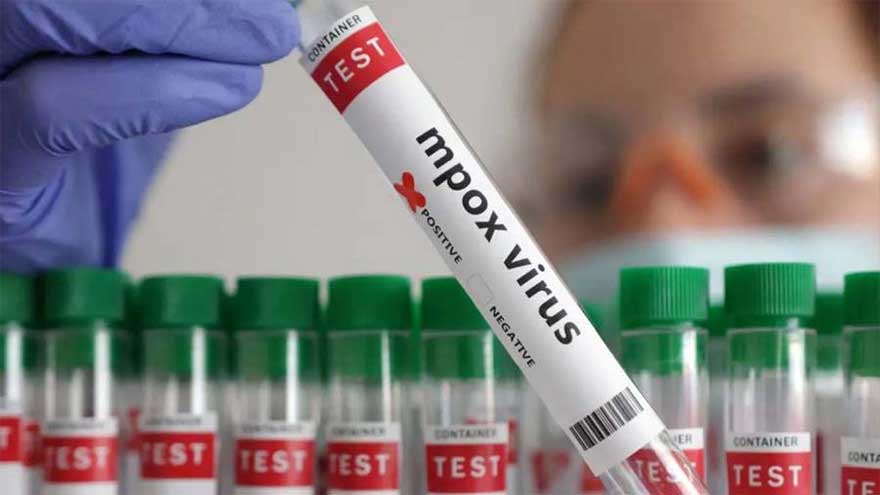 Four newborns who tested positive for Mpox die in Khairpur