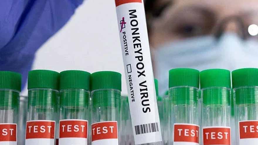Second Mpox case reported in Karachi