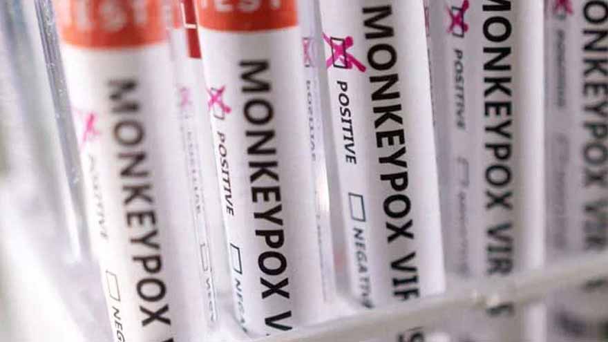 9 Mpox deaths, 25 cases reported across Sindh 