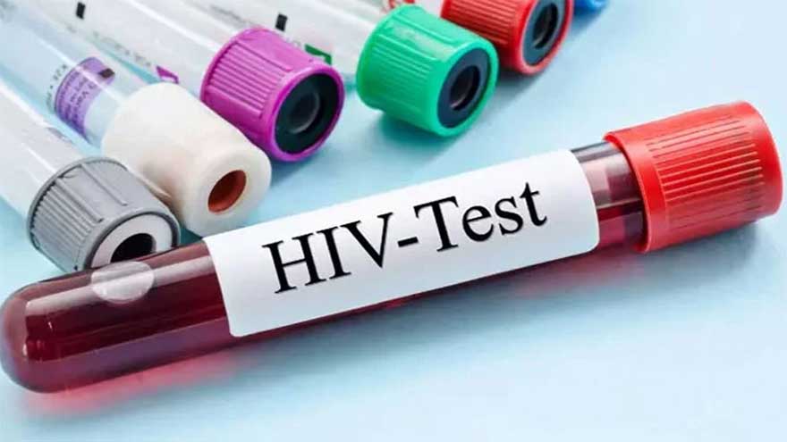 Urgent action urged amid Mpox outbreak, worsening HIV crisis in Pakistan
